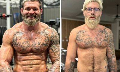 Gordon Ryan antes e depois do problema de saúde que o fez passar por cirurgia e pausar a carreira.