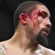 Robert Whittaker foi nocauteado por Dricus du Plessis no UFC 290