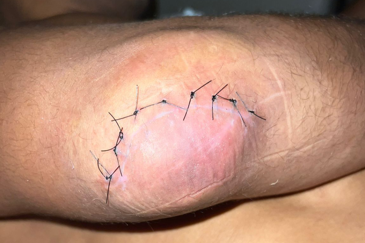 Fisioterapeuta descarta erro de Borrachinha para luta com Chimaev ser cancelada