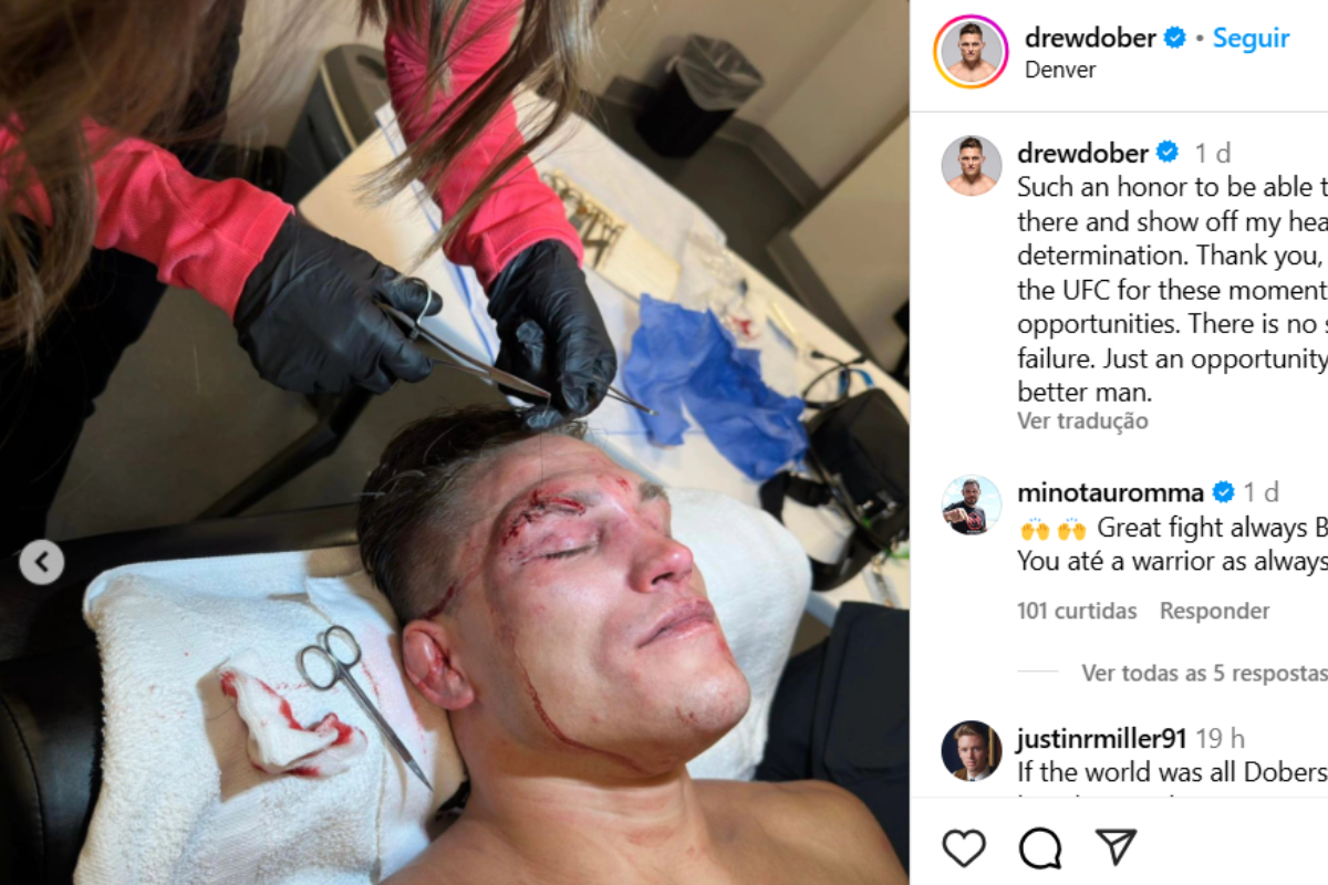 Rival mostra estrago feito por cotoveladas de Jean Silva no UFC Denver; veja