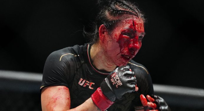 Imagem forte! Irene Aldana assusta com corte profundo na testa após luta no Noche UFC; veja