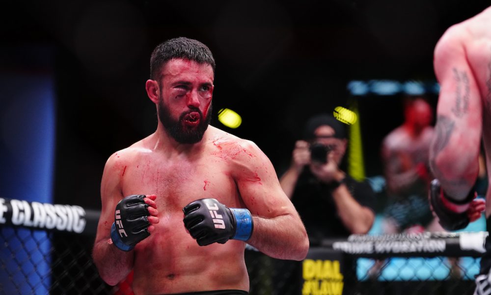 Daniel Frunza com o rosto desfigurado durante luta no UFC Vegas 105
