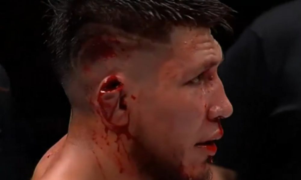 Zach Borrego sofreu uma lesão feia na orelha