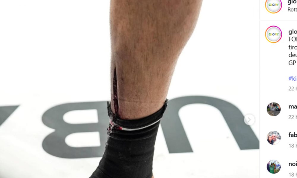 Corte profundo na canela de Jamal Ben Saddik no Glory 100