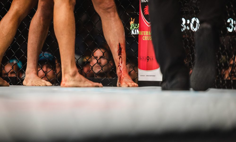 Wonderboy feriu a canela esquerda durante a luta contra Marretinha