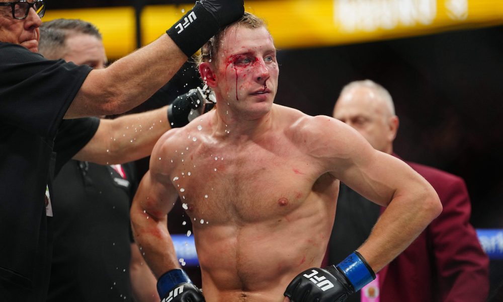 Paddy Pimblett ensanguentado no intervalo do duelo no UFC 324